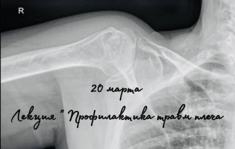 травмы плеча.jpg (103.22 КБ) Просмотров: 2615 травмы плеча.jpg